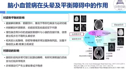 老年性头晕眩晕的常见病因,老年头晕如何根治