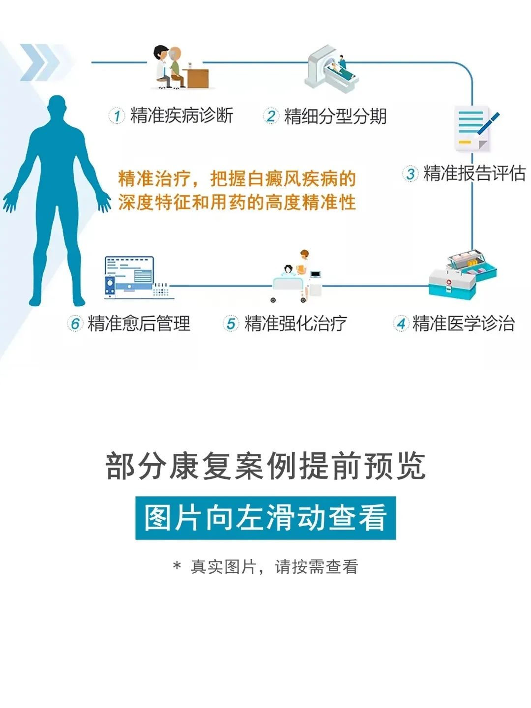 最新白癜风研究新药,白癜风临床试验招募2020