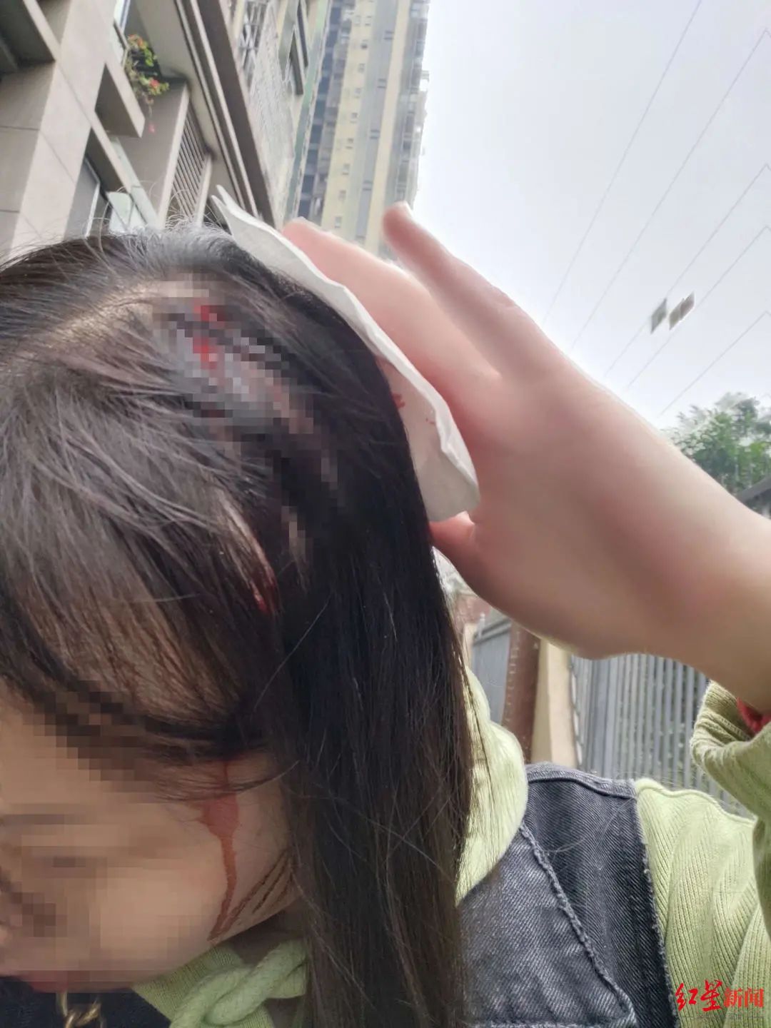 成都一小区内天降乌龟，路过女子被砸得头破血流