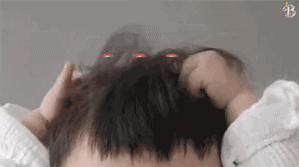 荨麻疹痒得要死,孩子荨麻疹痒死了怎么办