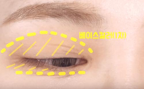 眼综合包含在眼综合吗,眼综合每个人都适合吗