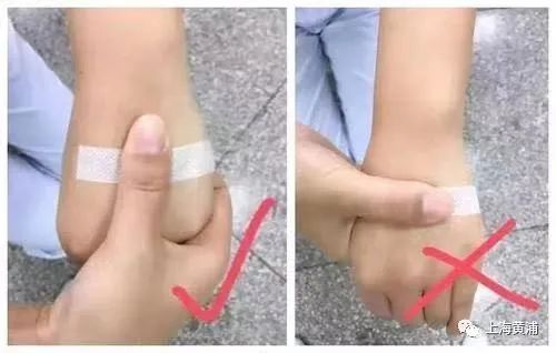 手上输液后黑青怎么办,手上输液有青块怎么快速消除