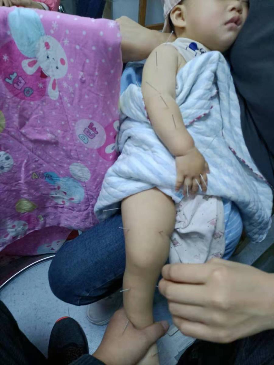 10个月大婴儿床上坠落致脑梗塞，负担不起高额治疗费，谁来帮帮这个家？