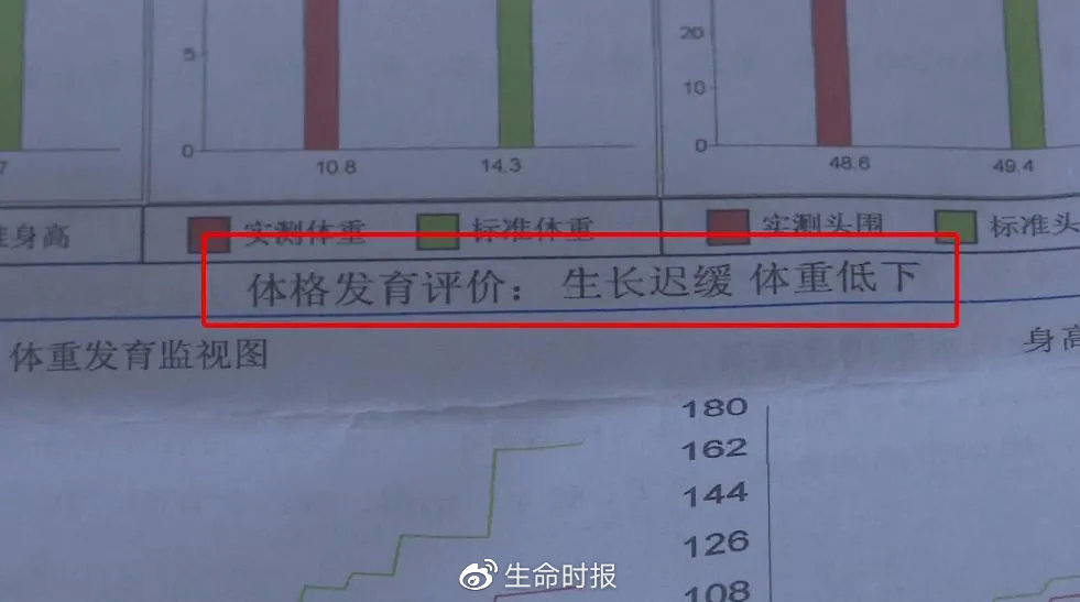 假奶粉喝出的大头娃,假奶粉喝了的症状图片