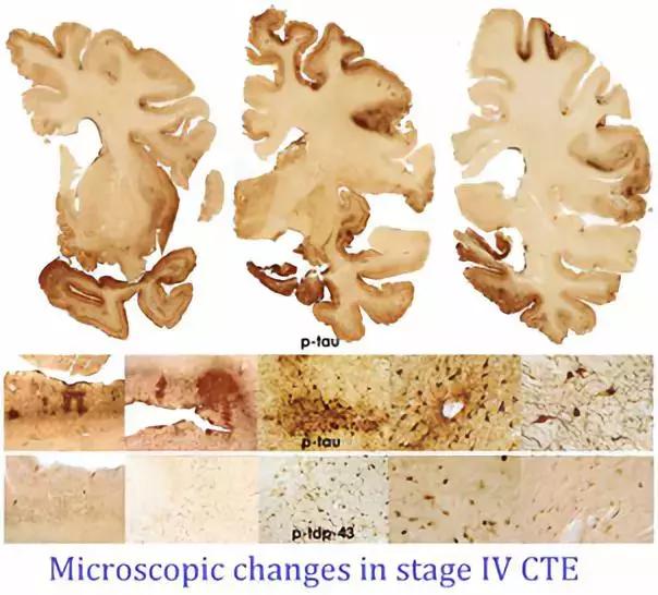 日报：人脑具有磁场感应能力；FDA批准创新疗法治疗过度嗜睡