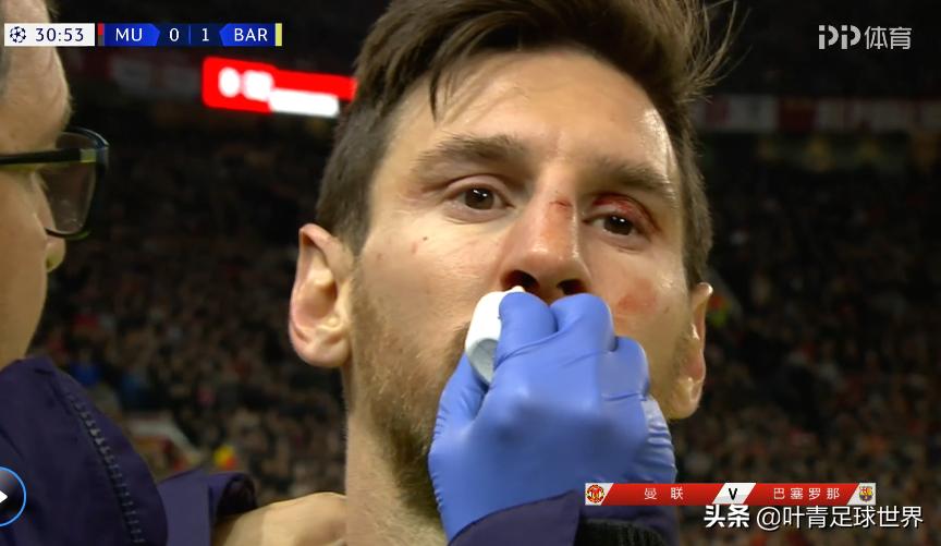 梅西遭1米92猛汉两连撞！倒在地上鲜血直淌，脸上出现3处伤痕