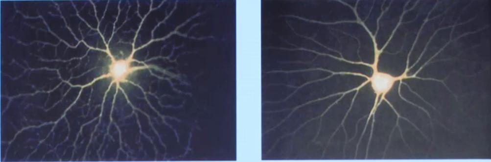 大脑的创造力主要蕴藏在哪里,大脑的自我意识是怎么产生的
