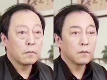 如何分清自己是哪种类型的眼袋,怎么看是哪种类型的眼袋