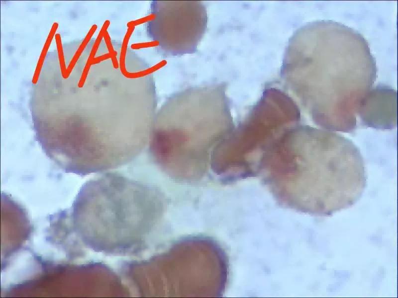 粒单不决问组化?有时还真不一定...