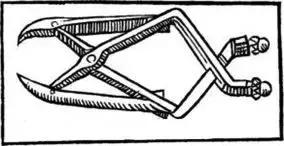 从尿道口取结石全过程,最先进的结石处理方法