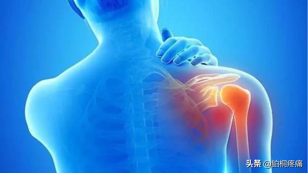 肩周炎胳膊疼的抬不起来怎么治疗,肩周炎手臂粘连抬不起来治疗方法