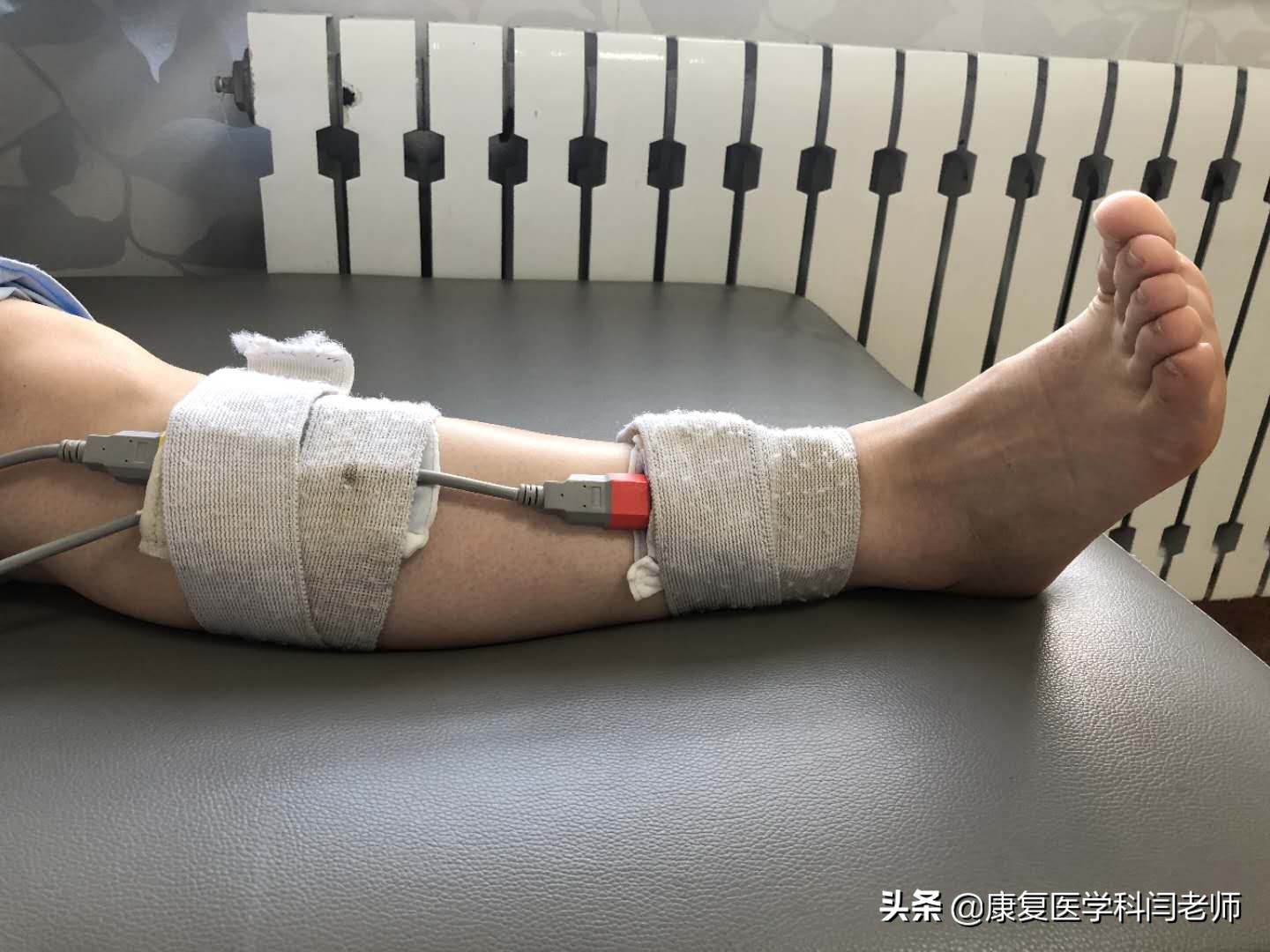 康复理疗中频治疗,中频电疗仪对偏瘫康复的作用