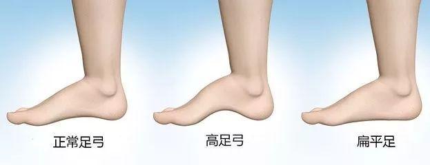 膝盖无力响,膝盖弹响且伴有疼痛怎么康复解决