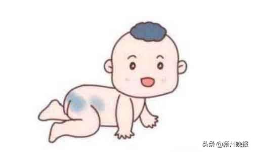 一次激光祛疤多少钱,一次激光治疗疤痕要多少钱