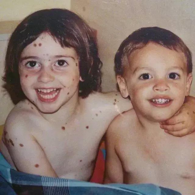 全身黑斑被骂“斑点狗”，身高160的她却成为最美超模…