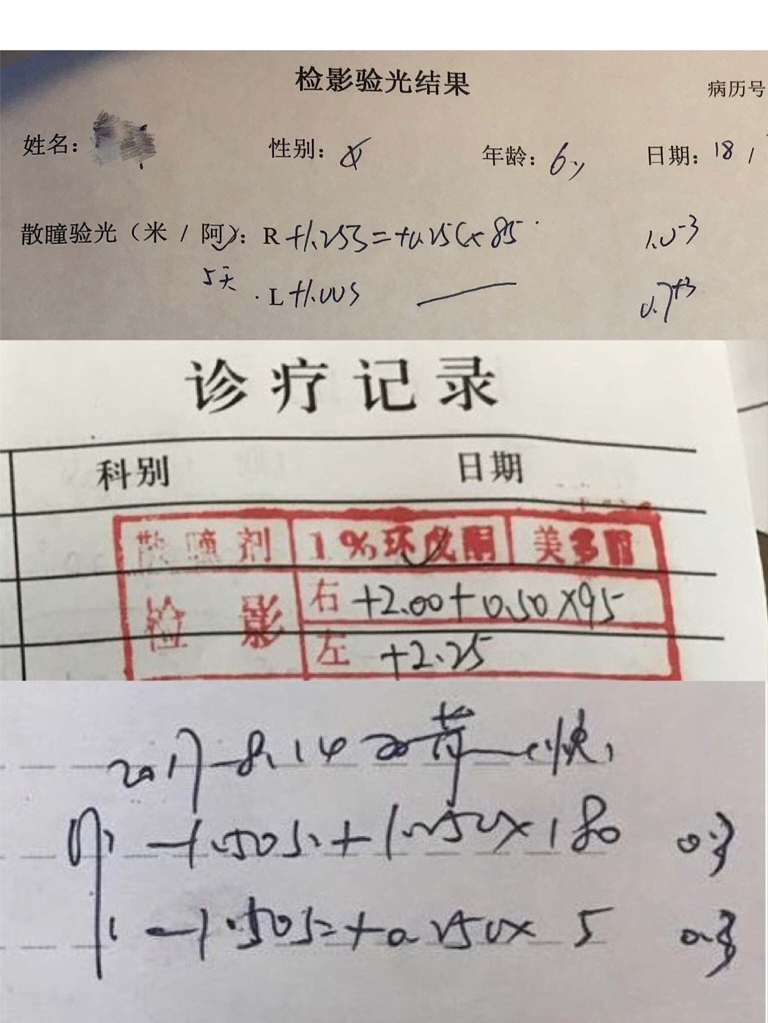 如何看懂眼科儿童验光单,怎么看懂视力验光单子