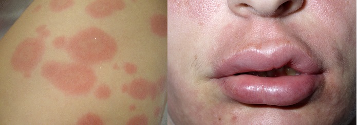 吃芒果觉得扎嘴有点痛,吃芒果遇到大危险