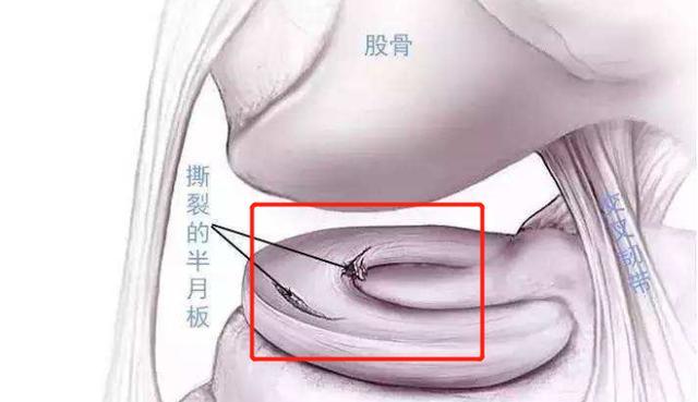 膝盖疼打封闭好还是中医针灸好,膝盖疼痛用什么药才能治好它