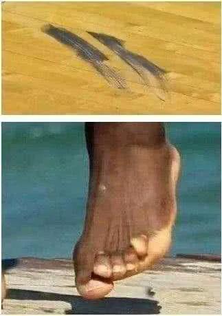 詹姆斯的脚有多可怕,詹姆斯脚踝有多厉害