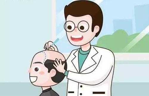 这就挺“秃然”的，揭开男性脱发原因，记得对症下药，挽留秀发