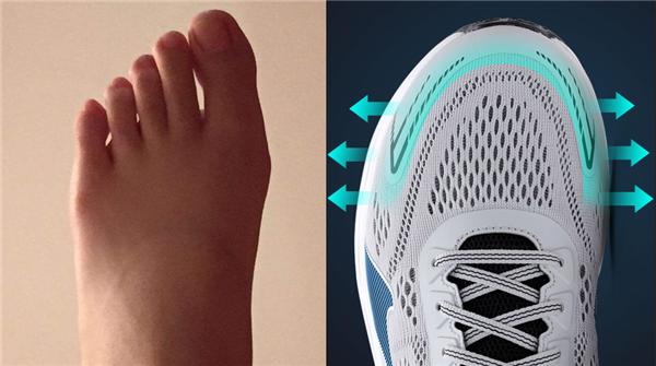 如何科学选鞋的五种方法,骨科医生教你五个挑好鞋的技巧