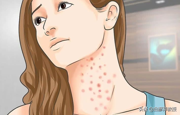 湿疹和荨麻疹症状有什么区别,红疹和湿疹的区别