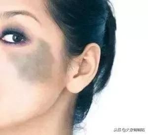 土豆片祛斑淡斑有奇效,淡斑祛斑护肤品或精油