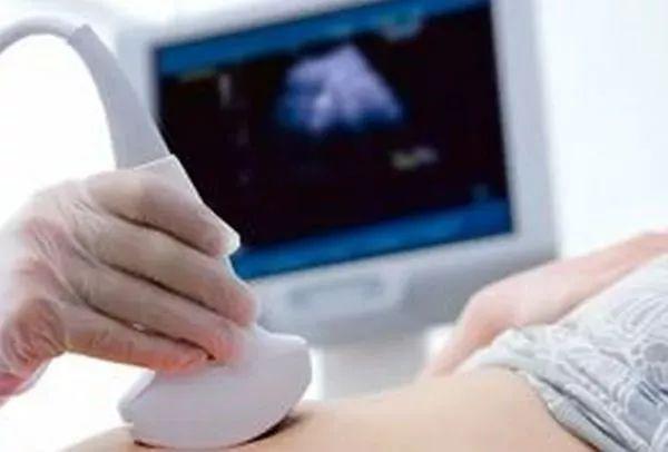 孕期B超做几次合适？做B超检查要注意哪些事？