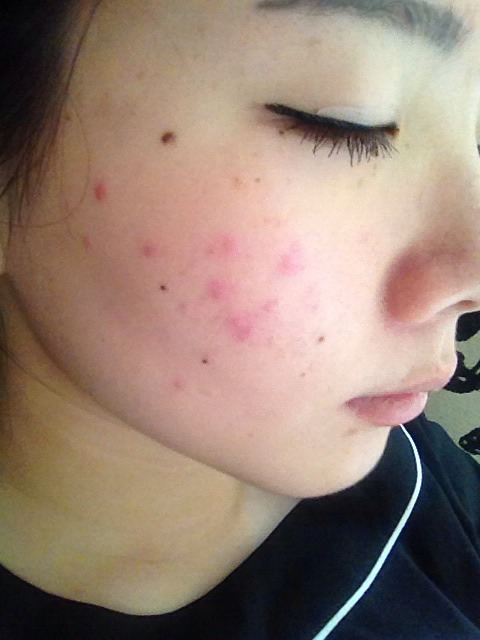 用了好多护肤品脸还是粗糙,化妆棉为什么越来越薄