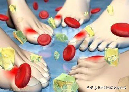 尿酸430伴有痛风需要吃降尿酸药吗,痛风怎么喝水降尿酸最快