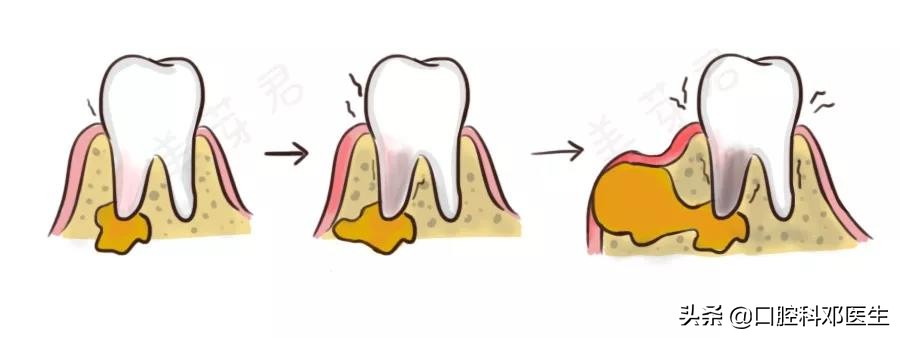 新型冠状病毒肺炎患者怎么治疗,新肺炎疫情有无治疗方法