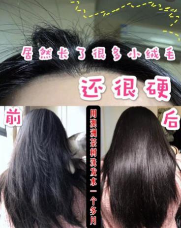 澳洲茶树精油洗发水去头屑,头发一摸全是油