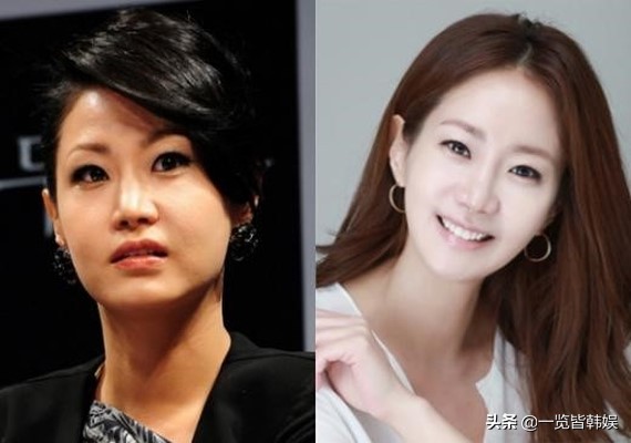 47岁申恩庆图片,47岁申恩庆削骨现状