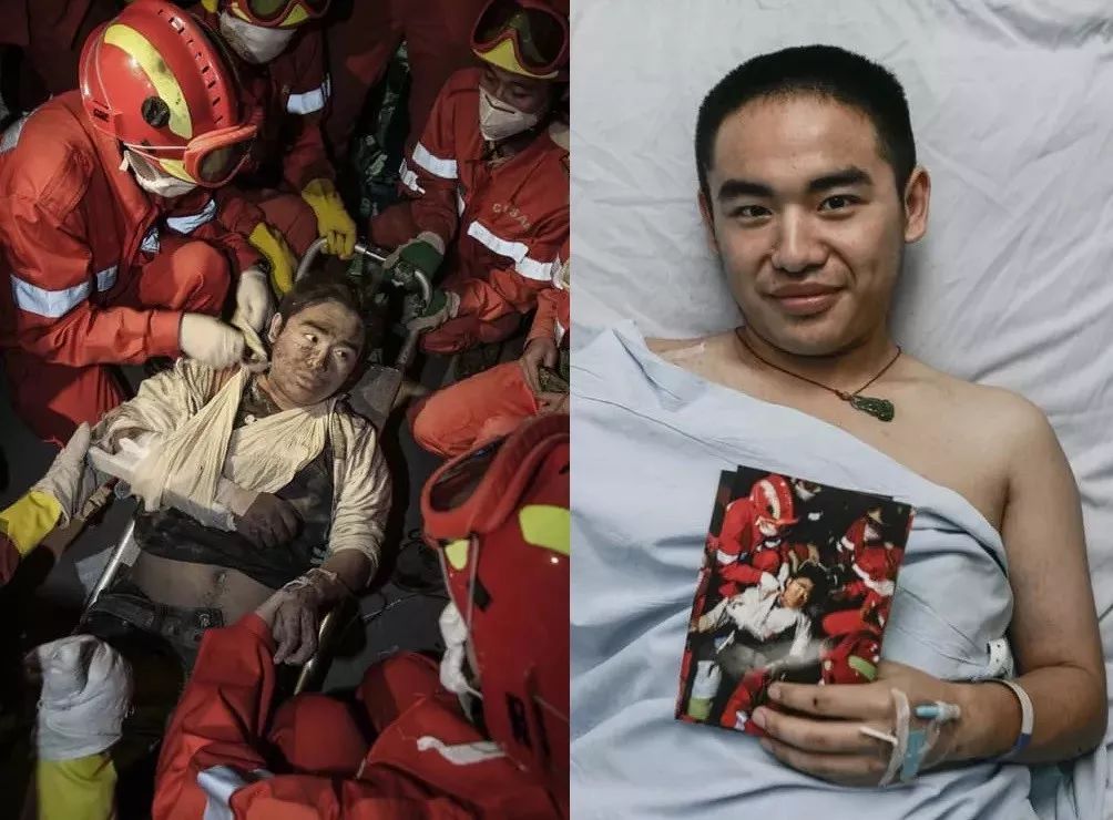 汶川地震中活下来的可乐男孩,汶川地震幸存假肢男孩