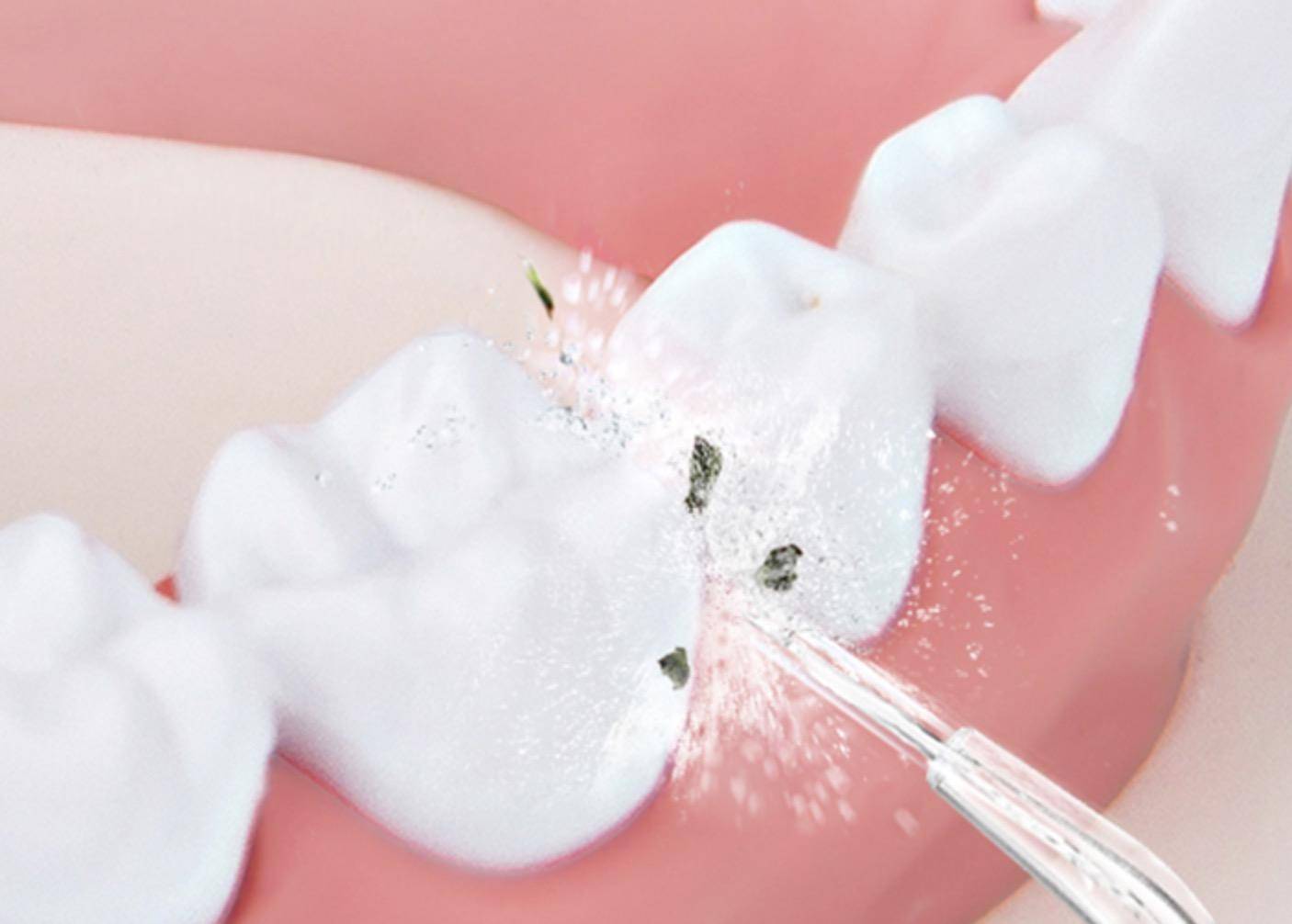 罗曼洗牙器价格,罗曼丁香洗牙神器