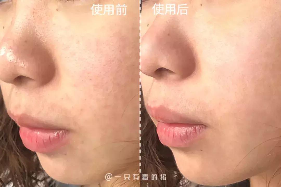 深层清洁面膜推荐网红,网红清洁面膜红黑榜