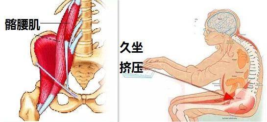 久坐腹股沟酸胀是怎么回事,久坐腹股沟疼痛的原因