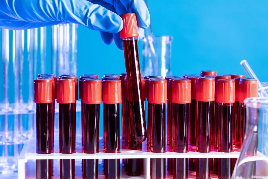 血液粘稠警惕四种表现,警惕这十种信号