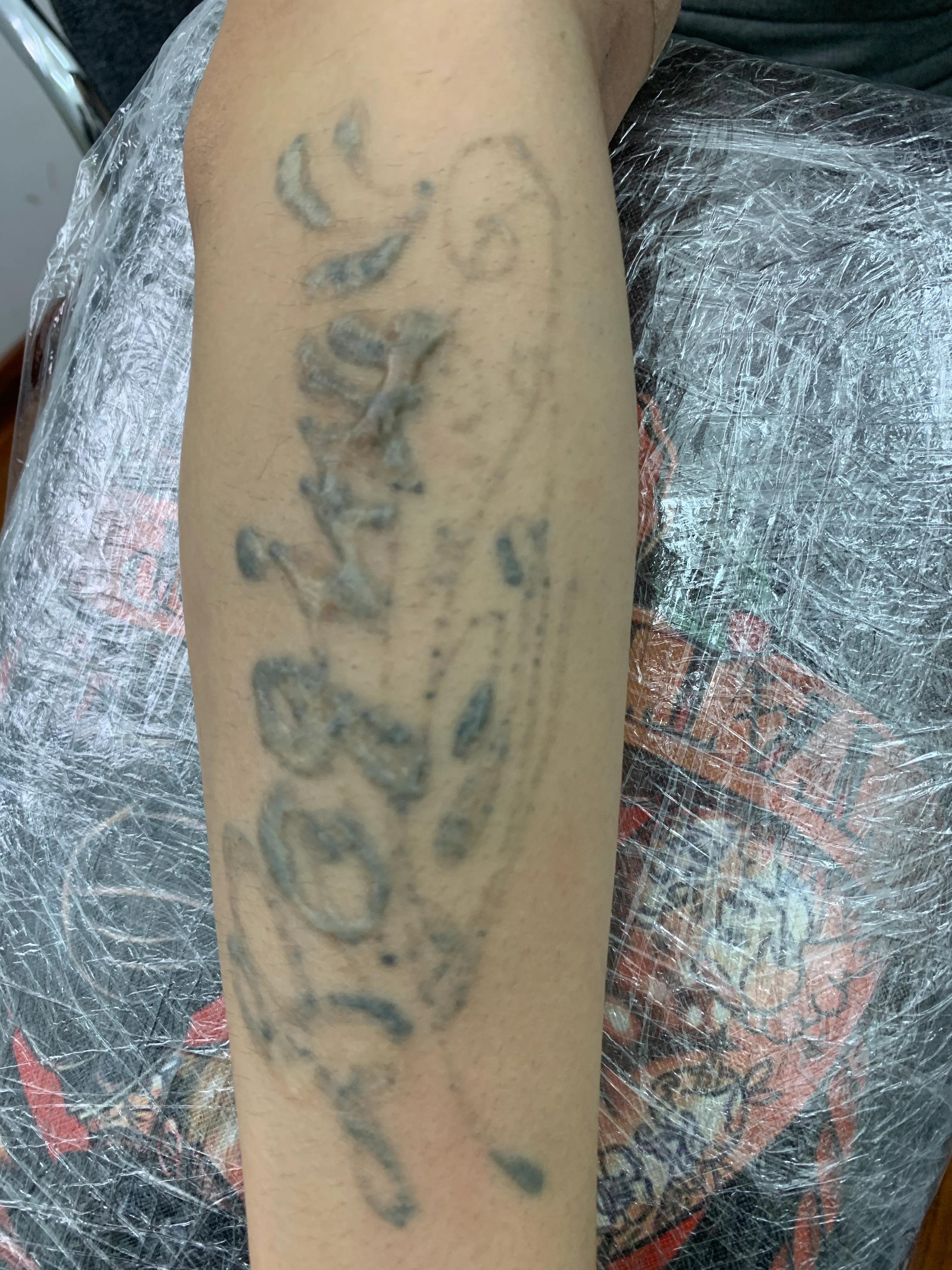 洗纹身到底能不能洗干净,洗纹身能不能彻底洗干净