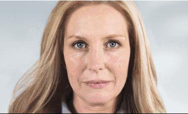 王菲代言的童颜针好吗,王菲童颜针后面部变化