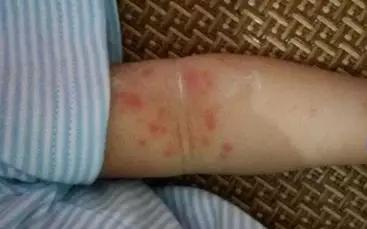 农科院研发的纯植物护肤品,农科院研究的护肤品