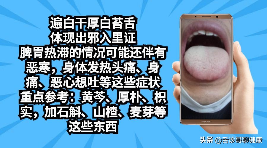 抖音舌诊哥舌象感悟:强迫症、大便不成型、忧心忡忡