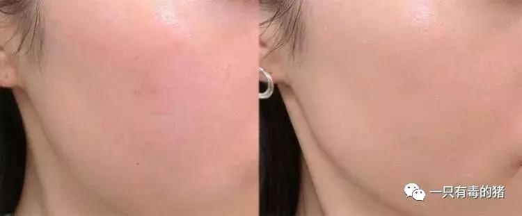 雅诗兰黛粉底液最好的一款,雅诗兰黛粉底液经典款