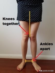 体态矫正训练o型腿扁平足,体态矫正x型腿