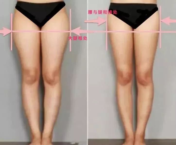 大腿外侧凸起怎么穿搭,大腿内侧两块赘肉穿裤子很难看