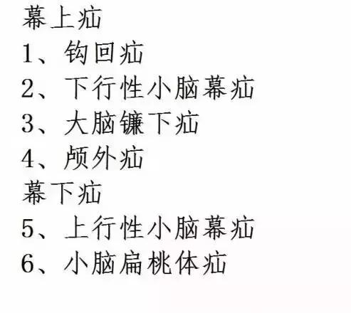 面神经分布图片大全,怎么记住面神经分布