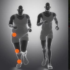 上下楼腿弯疼痛是什么原因,哪几种病导致上下楼梯膝盖疼