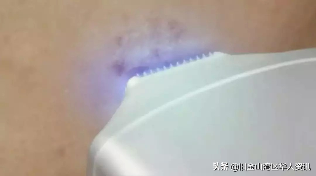 鑴搁儴澶勭悊ps,鐟曠柕鑴镐慨澶峱s