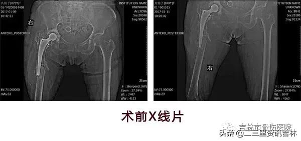 从医30余年，他治疗数以万计骨伤骨病患者