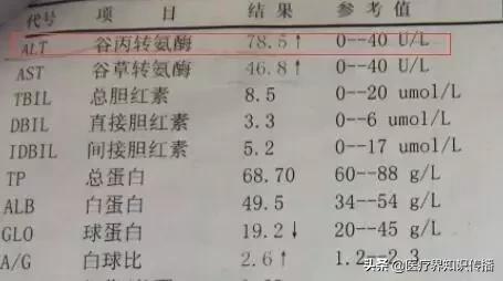一张图看懂乙肝化验单肝功能正常,肝功能指标怎么查医生来教你